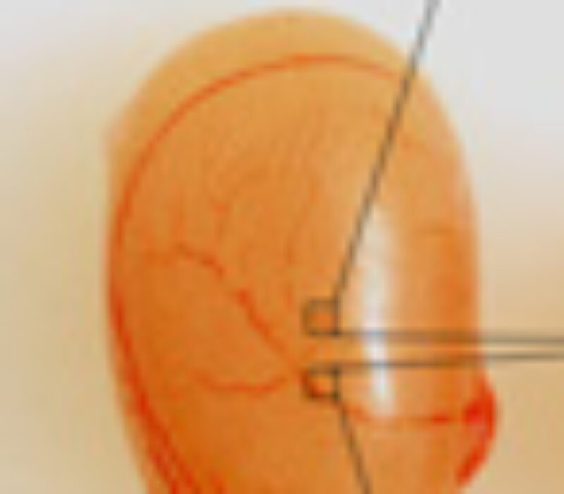 Stamceller og kjønnsceller viser oss hvordan genene våre skrus av og på