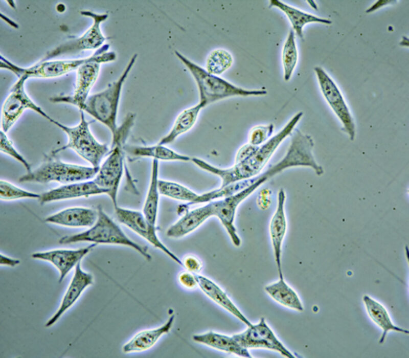 Arvestoffet til prostatakreftsvulstar kartlagt