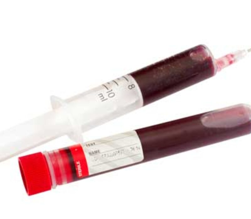 Gentesting: Skal foreslå retningslinjer