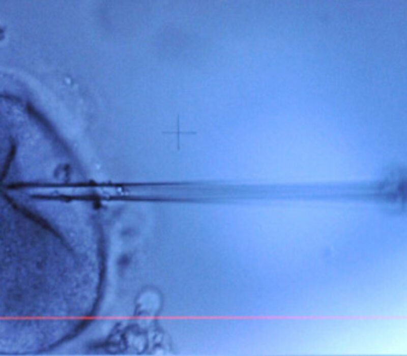 Vurderer endring av eggceller