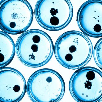 Petriskåler med synlige bakteriekolonier