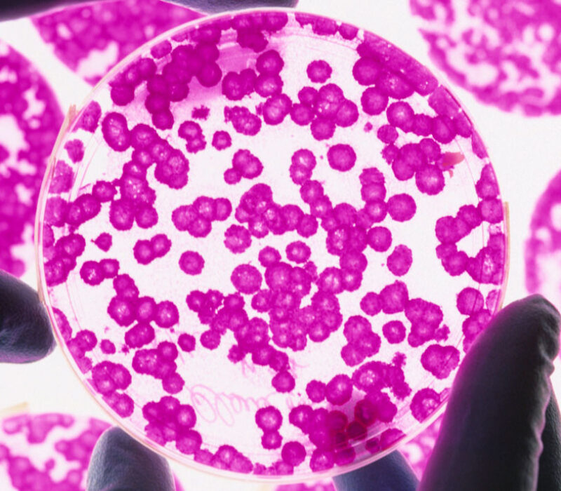 Er bioteknologi løysinga på organmangelen?