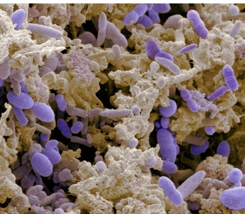 Din bedre, verre halvdel