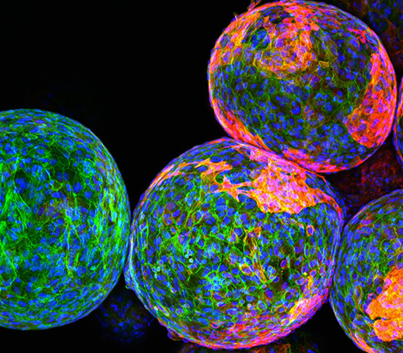 Stamceller mot diabetes