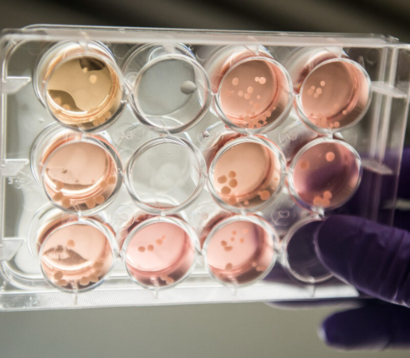 Gjennombrudd for zika-forskning: Skriver ut minihjerner i 3D