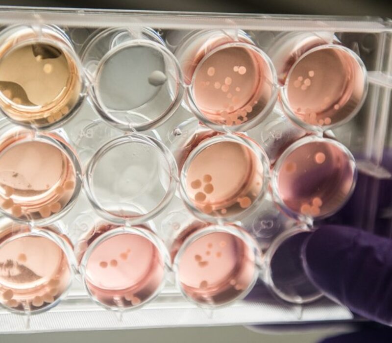 Stamceller – fra hype til håp?