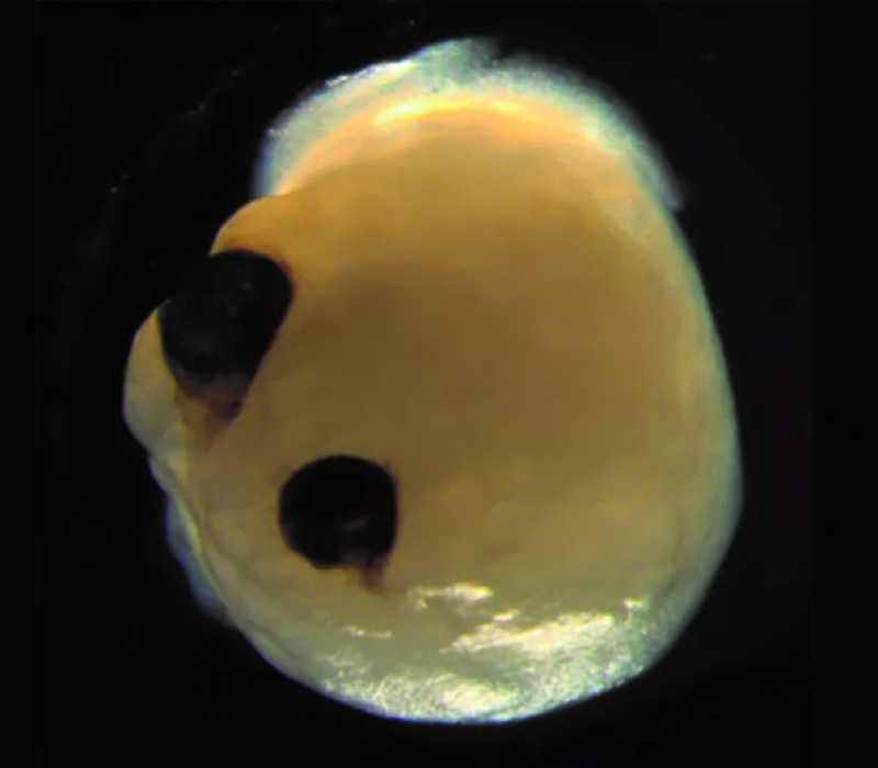 I GENialt: Tenke sjæl? Miniorganer utfordrer etikken