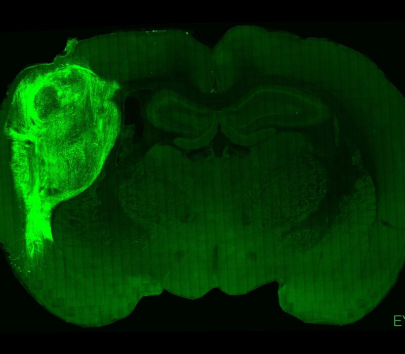 I GENialt: Rottehjerne med hjerneorganoider