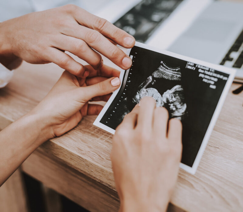 Fosterdiagnostikk kan påverke abortvurderingar