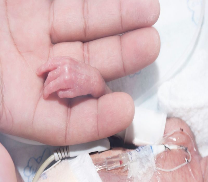 Kunstig livmor som kuvøse