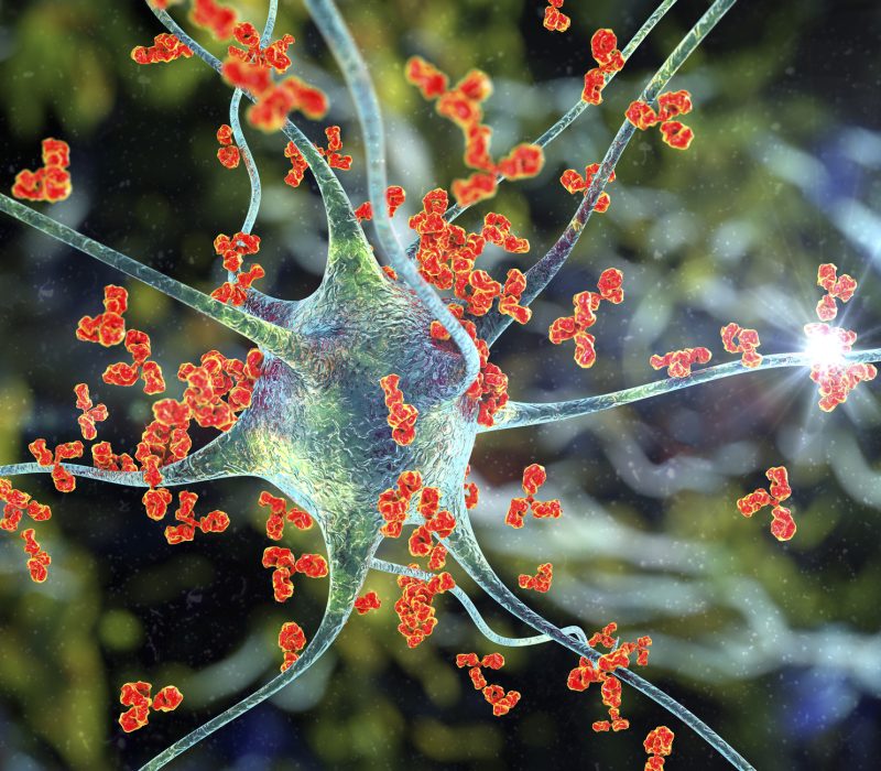 CAR T-celleterapi mot autoimmune sykdommer