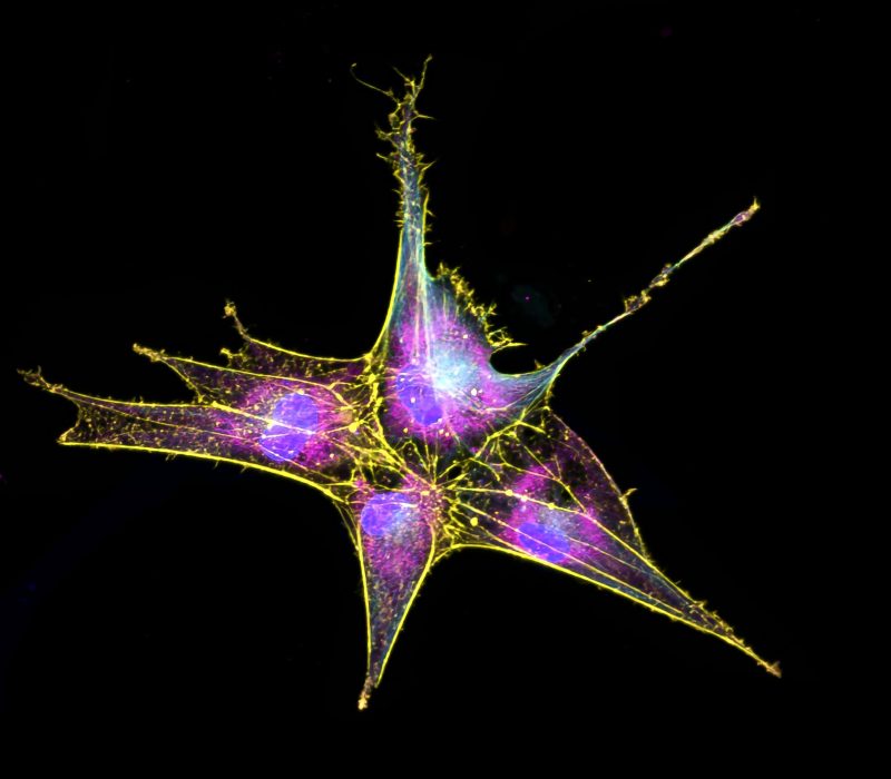 Fotoutstilling: Stamceller i fokus