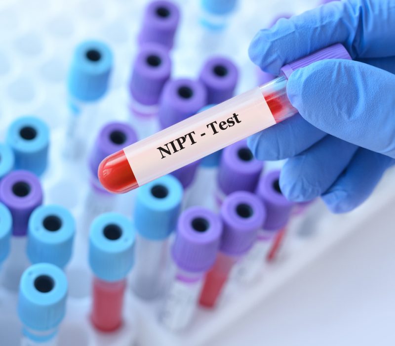 Fant kreft hos mor etter uvanlige NIPT-resultater